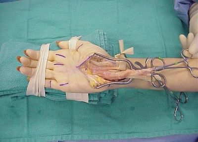 surgery3.jpg
