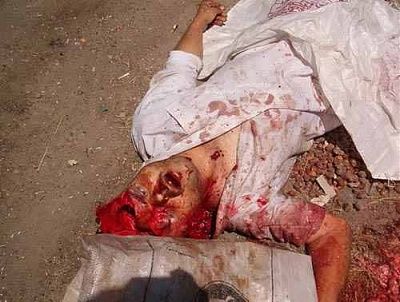 iraqi_bloodied_body-206-20lr.jpg