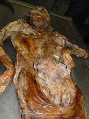 srebrenica-suha-mass-grave-bosnian-muslim-civilians-burned-alive-srebrenica-genocide.jpg