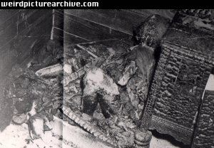 burnedchild.jpg
