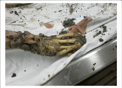 hand-decomposition.png