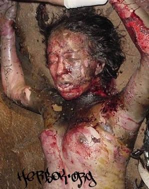 in_flames_burntwoman2-146c18c.jpg