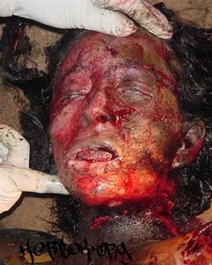 in_flames_burntwoman1-146c160.jpg
