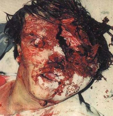 head_trauma.jpg