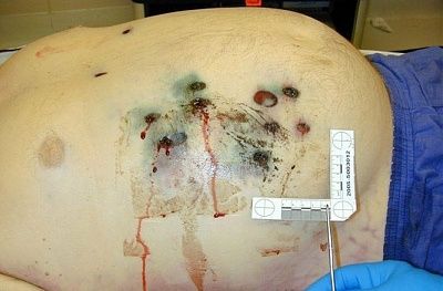 bellyblasted455n.jpg
