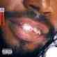 dirty teeth.jpg