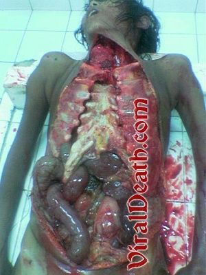 vd-morgue.jpg