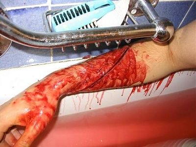 suicide_da42q_16298.jpg