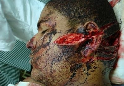 13893-man-hacked......-fuck-up-machetebig0.jpg