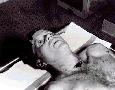 autopsy1.jpg