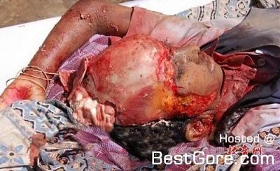 severe-head-trauma-03-500x306.jpg
