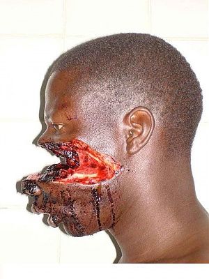 022010-huge-gash-face.jpg