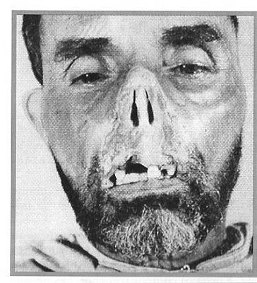 101-_torture_8a_alger-d1cfc.jpg