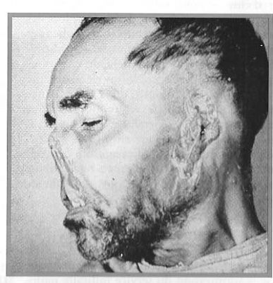 101-_torture_9a_alger-a04af.jpg