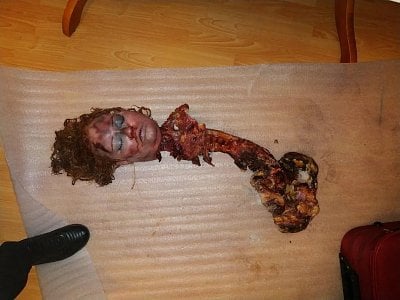 27-year-old-doctor-brutally-murders-his-girlfriend-after-v0-5b6eoyz39wy81.jpeg