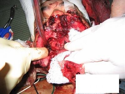 hapci1-1s.jpg
