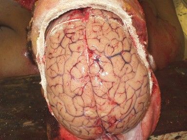137-EMA1058rCEREBRO.jpg