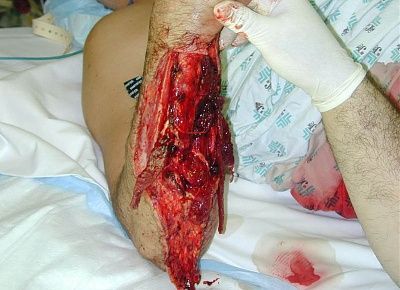 sick1.jpg