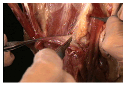 Dissecting-styloglossus.gif