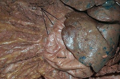 arteries-stomach.jpg