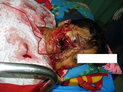 viraldeath_com-extreme-face-fuck-up.jpg