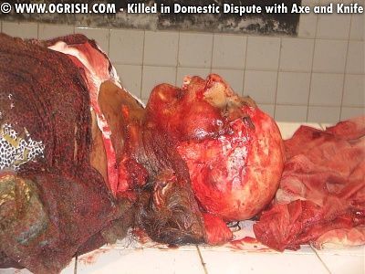 144692d1269810314-scalped-1.jpg