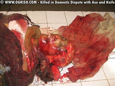 144693d1269810339-scalped-2.jpg