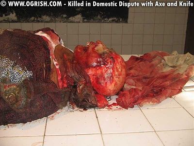 144694d1269810440-scalped-3.jpg