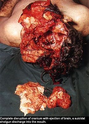 112110.thumb.jpg