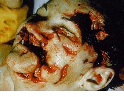 112065.thumb.jpg