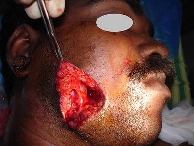 02-laceration.jpg