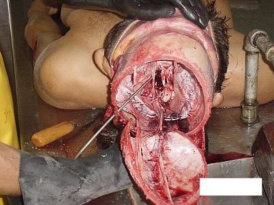 imagen-240.jpg