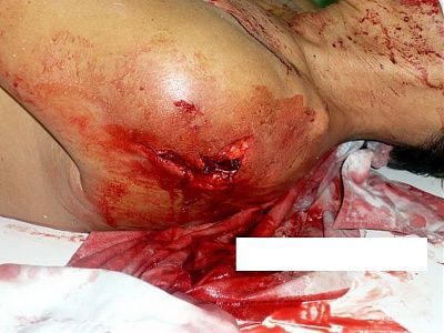 viraldeath_com-cock-eye.jpg