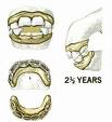 horseteeth.jpg