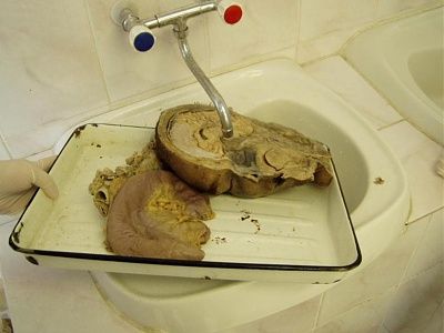 brains.jpg