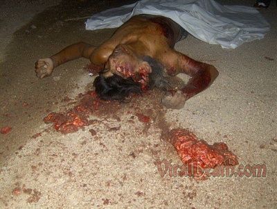 viraldeath_com-advanced-head-trauma-2.jpg