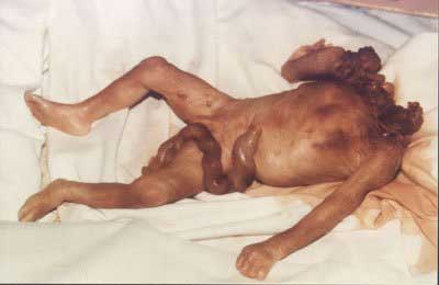 aabortion3.jpg