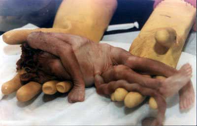 aabortion8.jpg