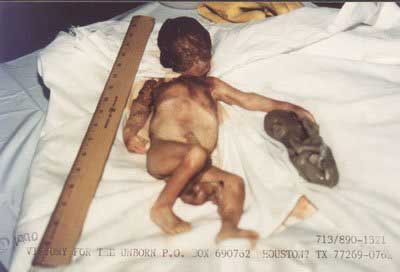 aabortion9.jpg