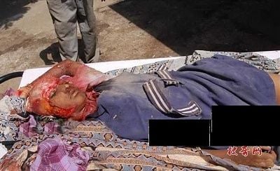severe-head-trauma-01.jpg