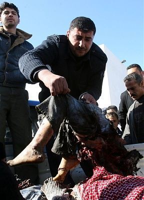 flesh-20colleceted-20in-20gaza.jpg