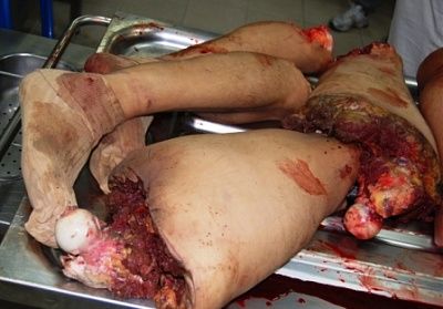09_33_05_270_policias_cercenados.jpg