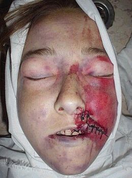 rachel-corrie-dead.jpg