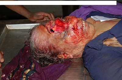 scooter_accident_saudi_arabia1.jpg