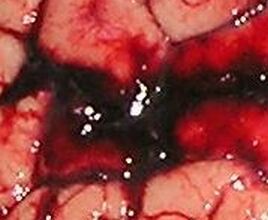 brain1.jpg