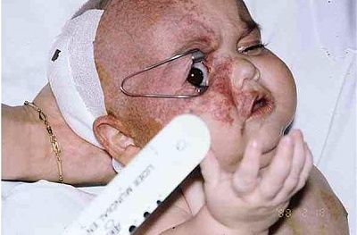 deadbaby004.jpg