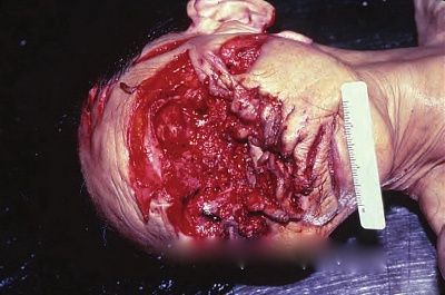 viraldeath_com_axe_to_the_face1421.jpg