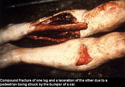 112045.thumb.jpg