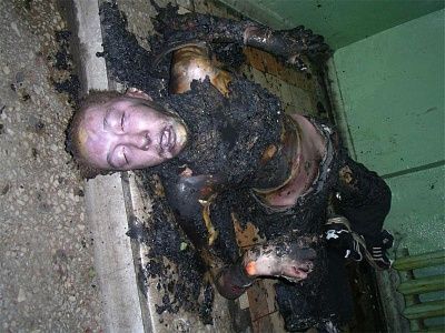c1-715135-burnt-guy.jpg