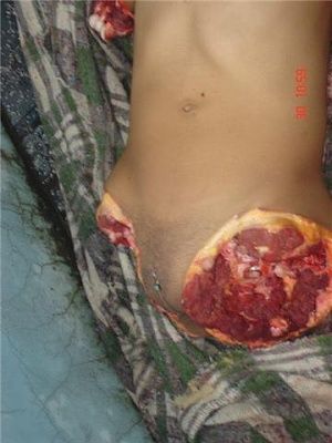 dismembered-female-body-9.jpg